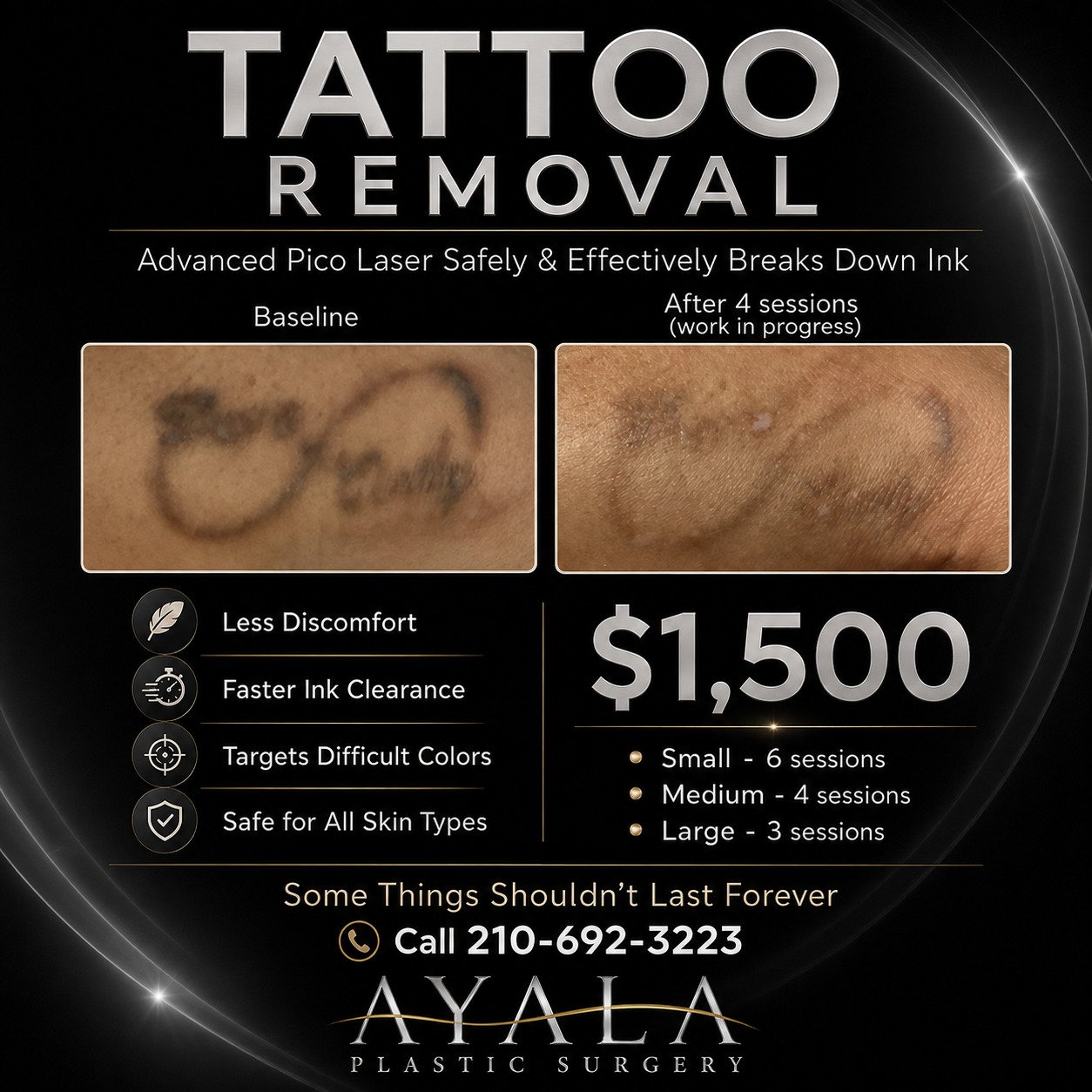 Ayala Plastic Surgery tattoo removal special: before and after four Pico laser sessions, with $1,500 package pricing