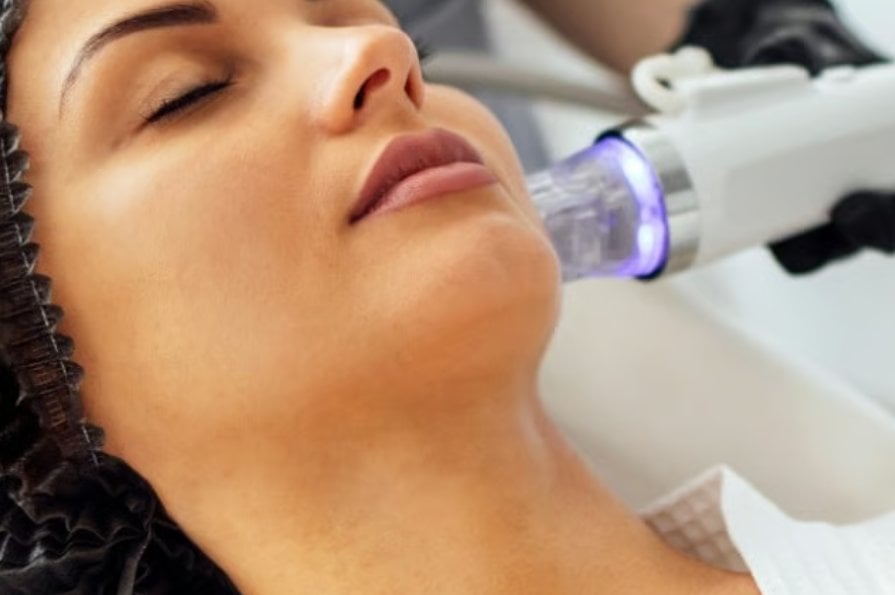 Woman receiving a microneedling treatment along her jawline