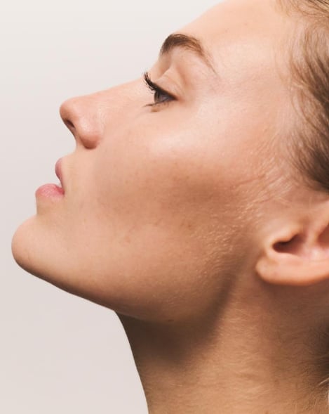 Profile of a woman's jawline and neck, the area Endolift treats